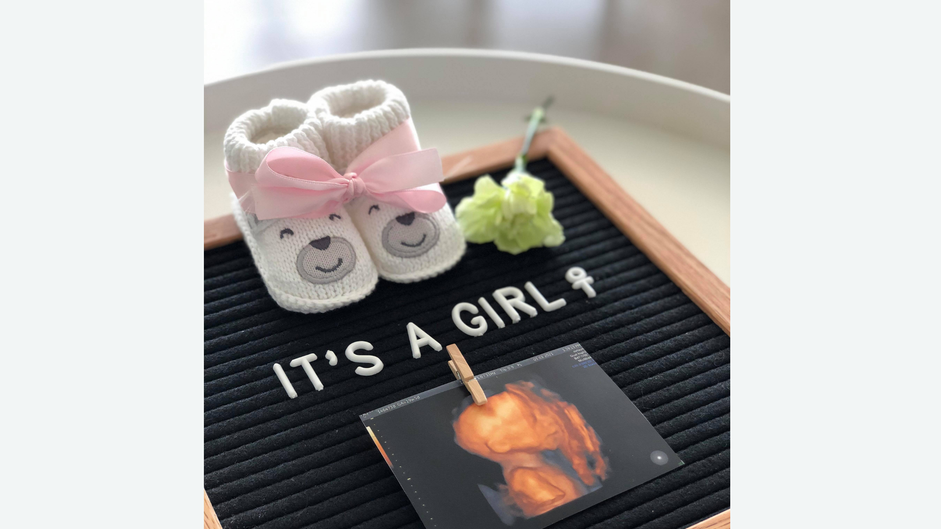 It’s a Girl: Reflections on International Women’s Day